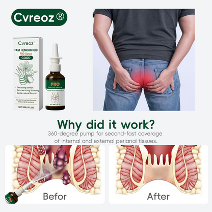 Cvreoz® Fast Hemorrhoid PRO Spray🌿