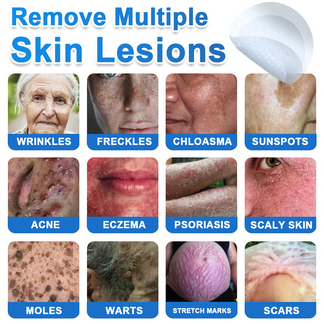 🎁2-in-1 Microneedle & Hydrocolloid Patch | Raised Moles,Acne, Flat Warts & Skin Tags Remover | Improves Wrinkles, Scars & Blemishes🎁