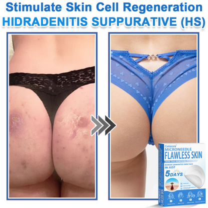 🎁2-in-1 Microneedle & Hydrocolloid Patch | Raised Moles,Acne, Flat Warts & Skin Tags Remover | Improves Wrinkles, Scars & Blemishes🎁
