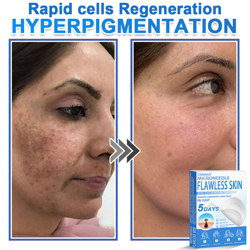 🎁2-in-1 Microneedle & Hydrocolloid Patch | Raised Moles,Acne, Flat Warts & Skin Tags Remover | Improves Wrinkles, Scars & Blemishes🎁