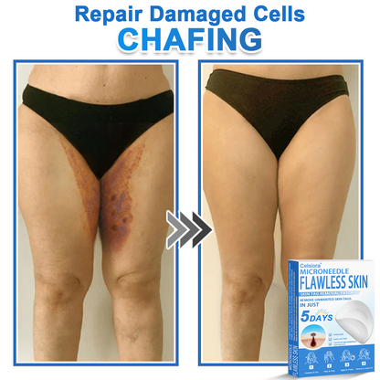 🎁2-in-1 Microneedle & Hydrocolloid Patch | Raised Moles,Acne, Flat Warts & Skin Tags Remover | Improves Wrinkles, Scars & Blemishes🎁