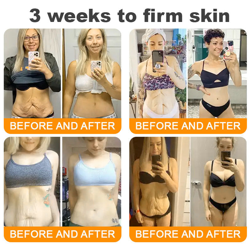 Dermavelle® Bee Venom Wrinkle Lifting & Firming Cream (Treats Wrinkles, Fine Lines, Skin Sagging, and Eye Bags)