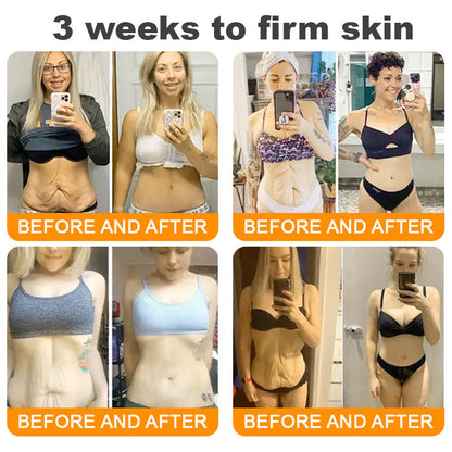 Dermavelle® Bee Venom Wrinkle Lifting & Firming Cream (Treats Wrinkles, Fine Lines, Skin Sagging, and Eye Bags)