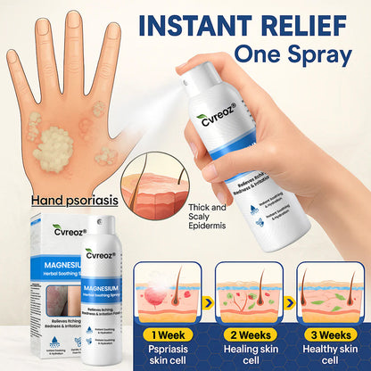 ✅  Official Store: Cvreoz® Magnesium Herbal Psoriasis Spray ⚕️