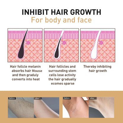 Seurico™ BeeSilk Hair Removal Mousse（Best selling💥）