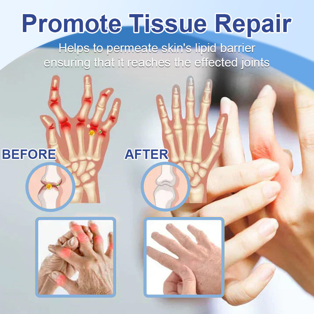 ✅Officially Recommended Osteovira® Advanced Magnesium Pain Relief Cream (Treats Arthritis, Neuropathy, Rheumatism, Sports Injuries & More)