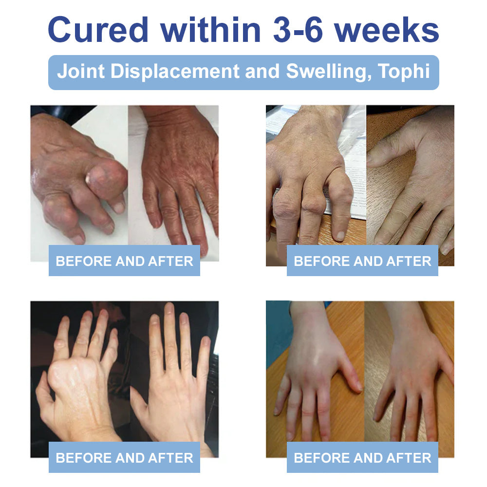 ✅Officially Recommended Osteovira® Advanced Magnesium Pain Relief Cream (Treats Arthritis, Neuropathy, Rheumatism, Sports Injuries & More)