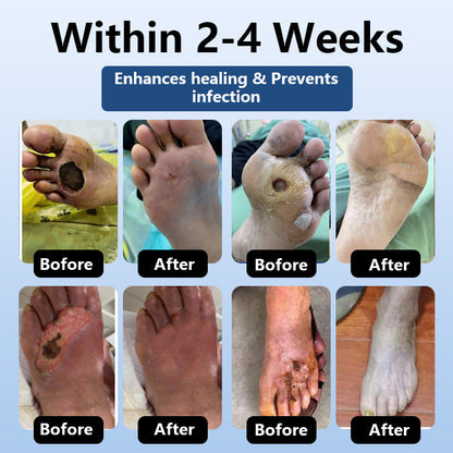 🌿DiabeHeal™ Diabetic Skin Healing Cream🌿