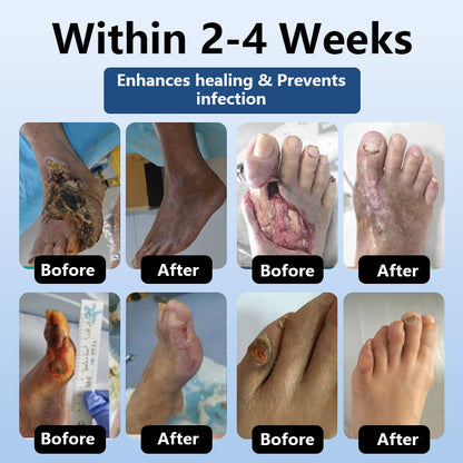 🌿DiabeHeal™ Diabetic Skin Healing Cream🌿