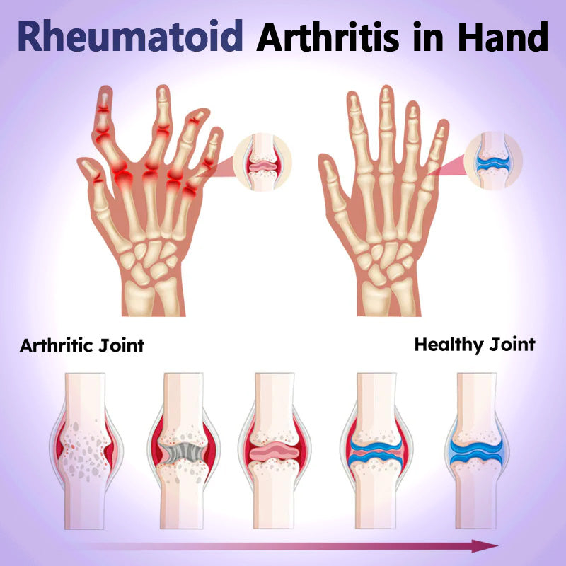 🍀Naturbelassen® Emu Oil And Turmeric Pain Gel👨‍⚕️  FDA Approved 💥