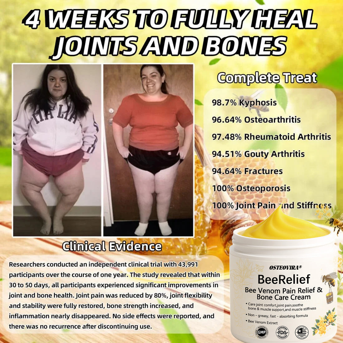 ✅Officially Recommended Osteovira® Bee Venom Pain Cream (Treats Arthritis, Neuropathy, Rheumatism, Sports Injuries & More)