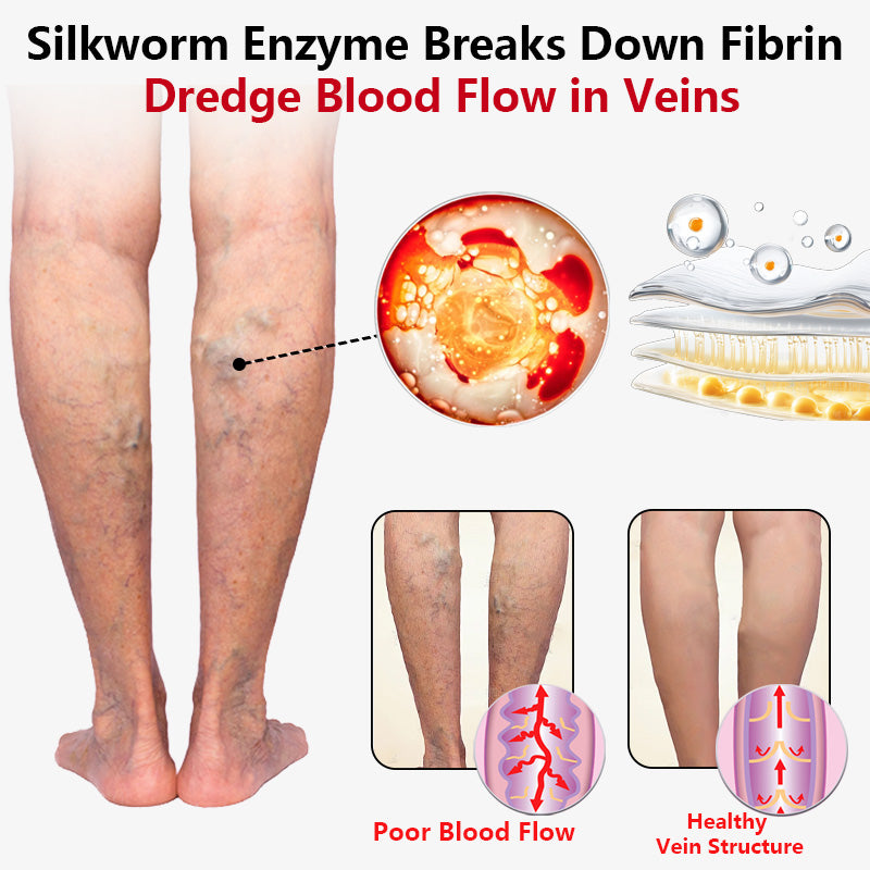 SEURICO™ Vein Dredge Silkworm Extract Spray 🌿✨ - Relief for Varicose Veins & Better Circulation 💪💧