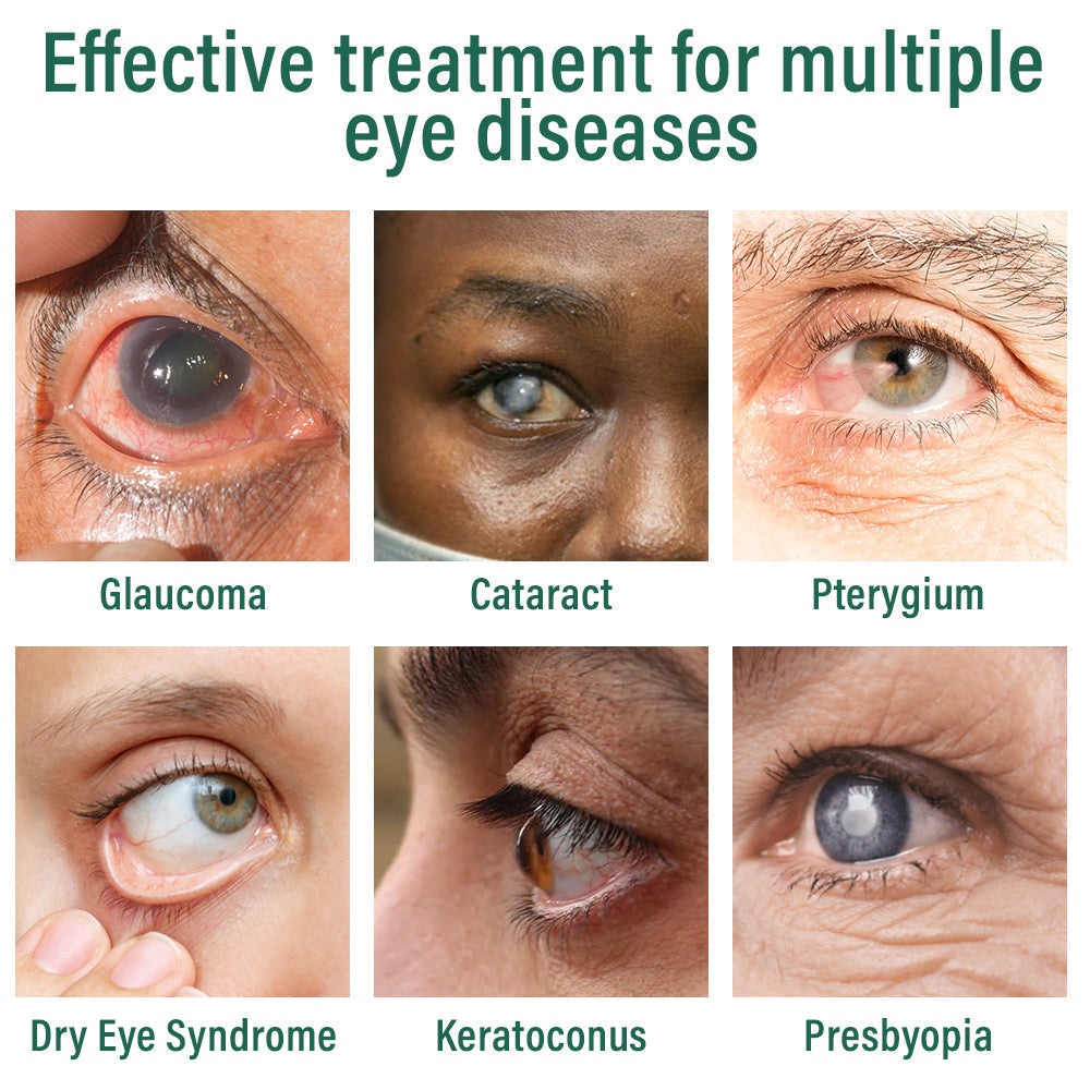 OcuVive® Nano Eye Drops Serum 👩‍⚕️ Ophthal mologists Recommended (Suitable for presbyopia, dry eye syndrome, glaucoma, cataracts and diabetic retinopathy) 🍀