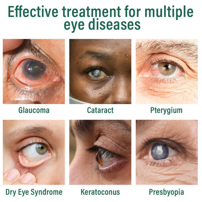 OcuVive® Nano Eye Drops Serum 👩‍⚕️ Ophthal mologists Recommended (Suitable for presbyopia, dry eye syndrome, glaucoma, cataracts and diabetic retinopathy) 🍀