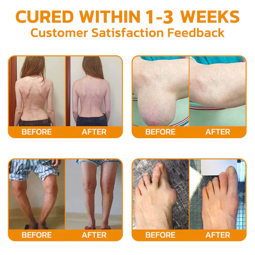 ✅ Official Store: SEURICO™ Bee Venom Joint Repair Cream 👨‍⚕️ American Orthopaedic Association (AOA) Approved (Reduces joint swelling, pain, stiffness, redness, warmth, soreness, and joint fatigue).