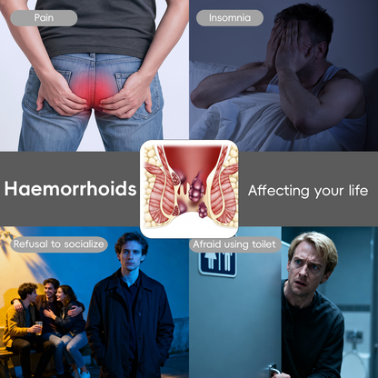 Cvreoz® Fast Hemorrhoid PRO Spray🌿