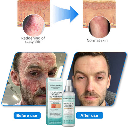 🌿 Herbalonix® Official Store Magnesium Herbal Repair Spray