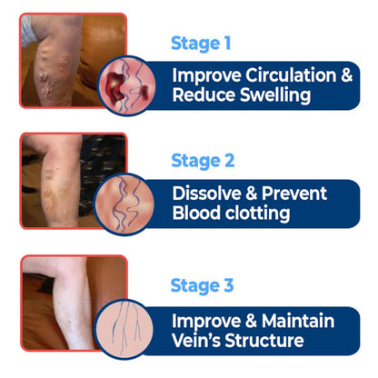 SEURICO™ Vein Dredge Silkworm Extract Spray 🌿✨ - Relief for Varicose Veins & Better Circulation 💪💧