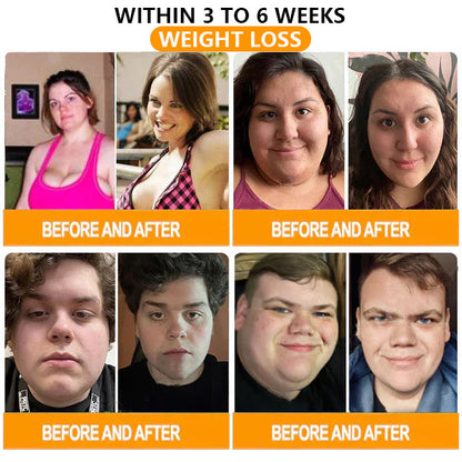 SEURICO™ Lymphatic Drainage & Slimming Foot Patches 🌿👣