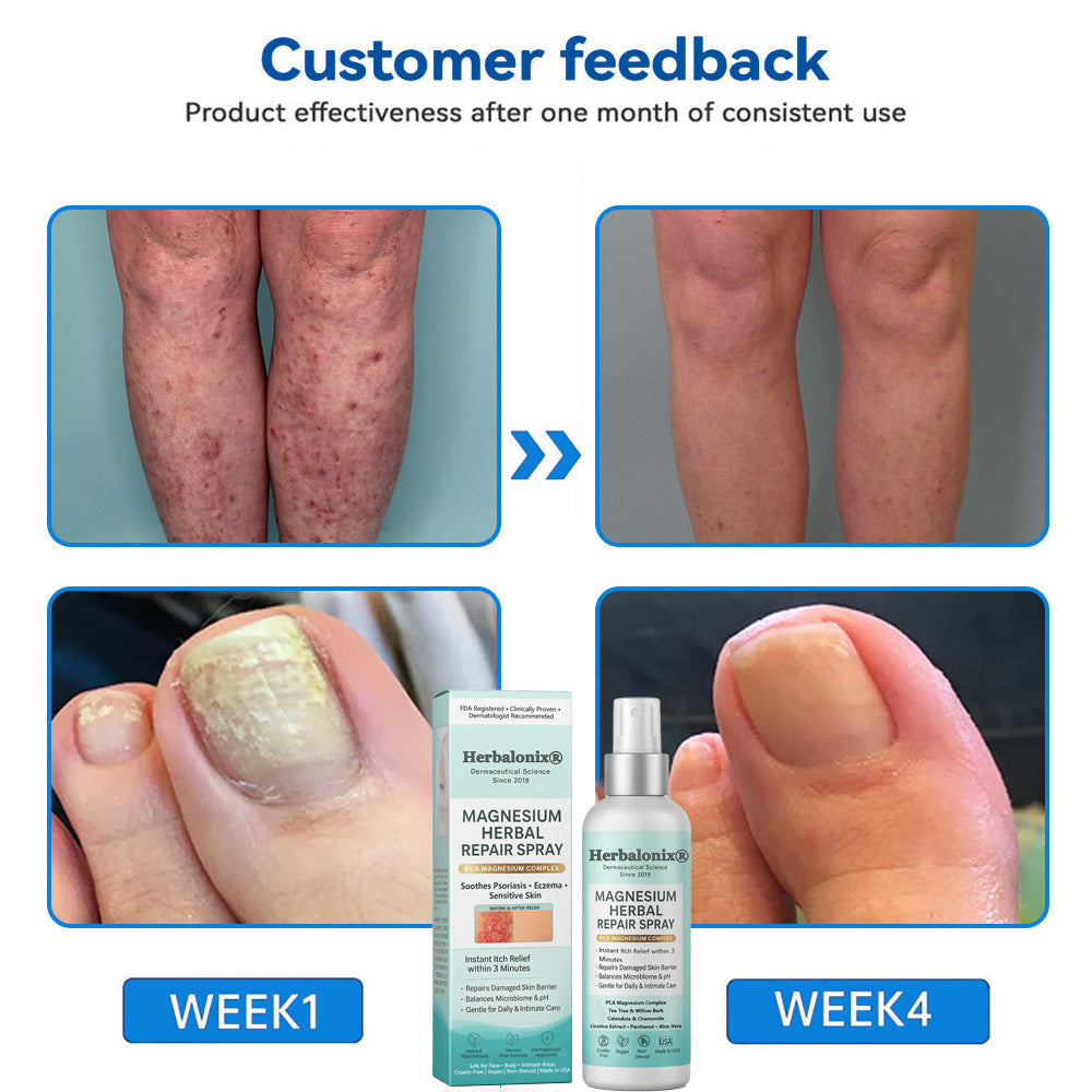 🌿 Herbalonix® Official Store Magnesium Herbal Repair Spray
