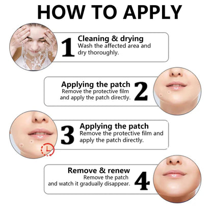 VanaSculpt® Pro MicroDarts TAG'Gone skin plaster for the removal of skin tags