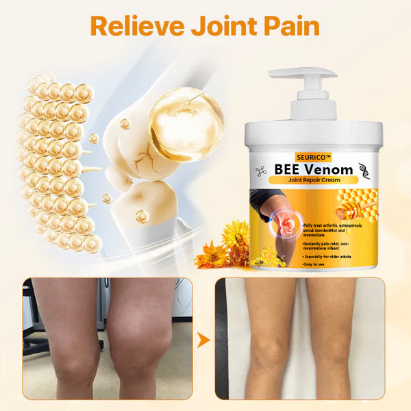 ✅ Official Store: SEURICO™ Bee Venom Joint Repair Cream 👨‍⚕️ American Orthopaedic Association (AOA) Approved (Reduces joint swelling, pain, stiffness, redness, warmth, soreness, and joint fatigue).