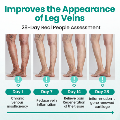 ✅Naturbelassen® Leg Renew Patch (For Varicose Veins, Spider Veins, Swelling & Leg Fatigue)✅