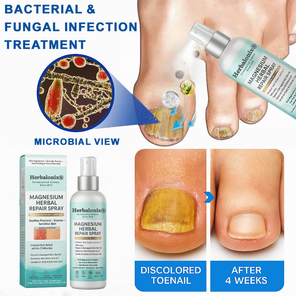 🌿 Herbalonix® Official Store Magnesium Herbal Repair Spray