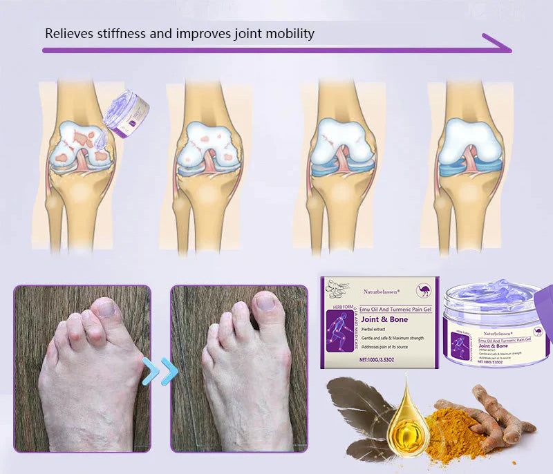 🍀Naturbelassen® Emu Oil And Turmeric Pain Gel👨‍⚕️  FDA Approved 💥