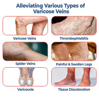 SEURICO™ Vein Dredge Silkworm Extract Spray 🌿✨ - Relief for Varicose Veins & Better Circulation 💪💧