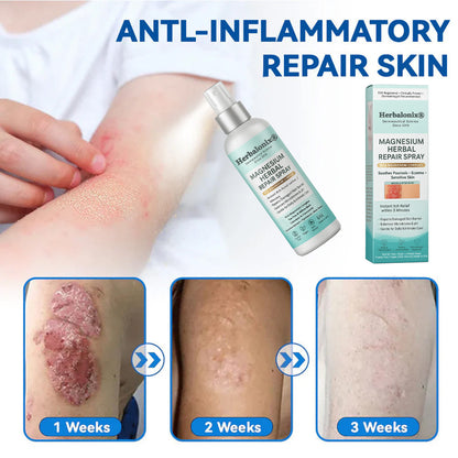 🌿 Herbalonix® Official Store Magnesium Herbal Repair Spray