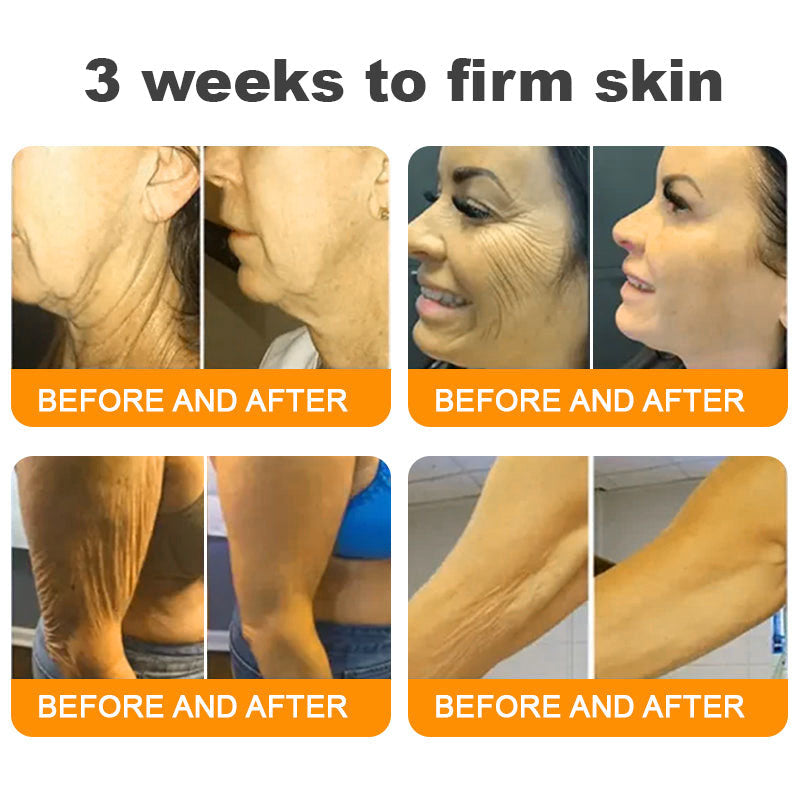 Dermavelle® Bee Venom Wrinkle Lifting & Firming Cream (Treats Wrinkles, Fine Lines, Skin Sagging, and Eye Bags)