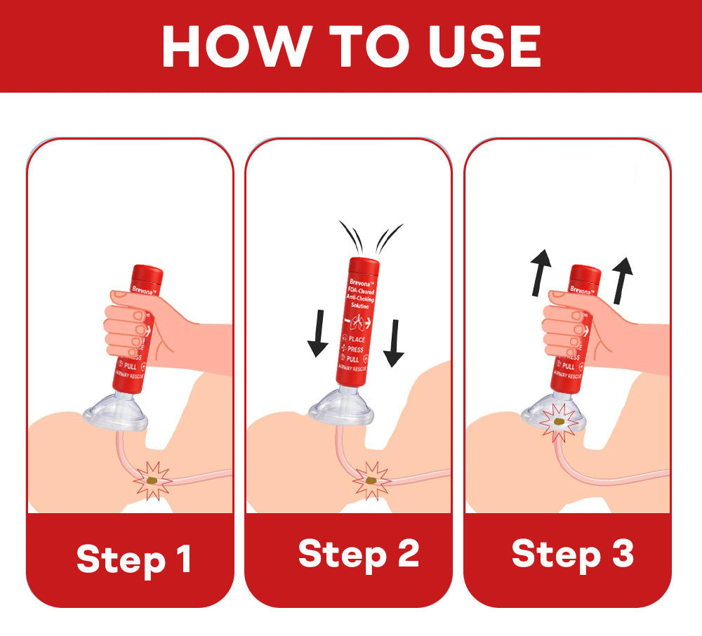 Newly Upgraded Brevona™ FDA-Cleared Anti-Choking Solution
