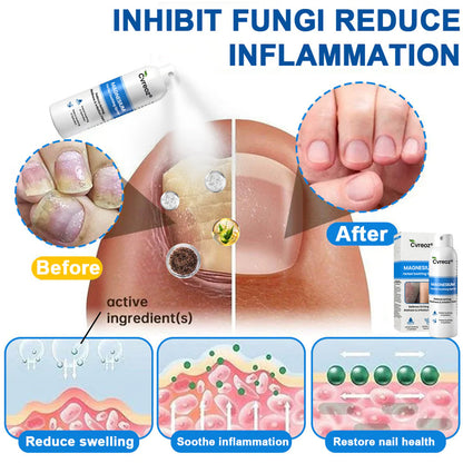 ✅  Official Store: Cvreoz® Magnesium Herbal Psoriasis Spray ⚕️