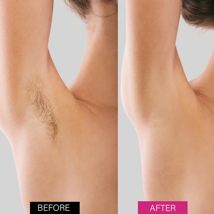 Seurico™ BeeSilk Hair Removal Mousse（Best selling💥）