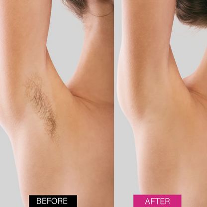 Seurico™ BeeSilk Hair Removal Mousse（Best selling💥）