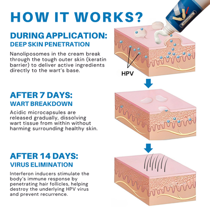 Vironexil® Clinical HPV Wart Therapy Cream for Men (Advanced Nanoliposome Delivery + Immune Activation for Root-Level HPV Wart Elimination)