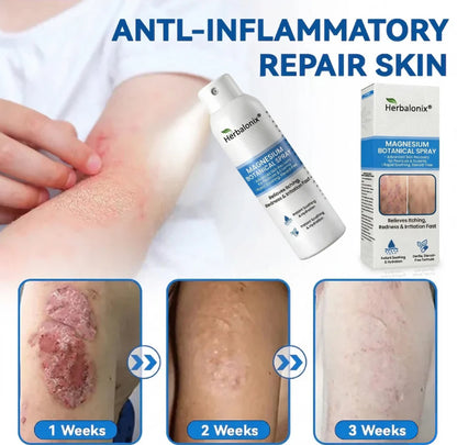 🔥Magnesium Botanical Spray – Advanced Skin Recovery for Psoriasis & Eczema | Rapid Soothing, Steroid-Free