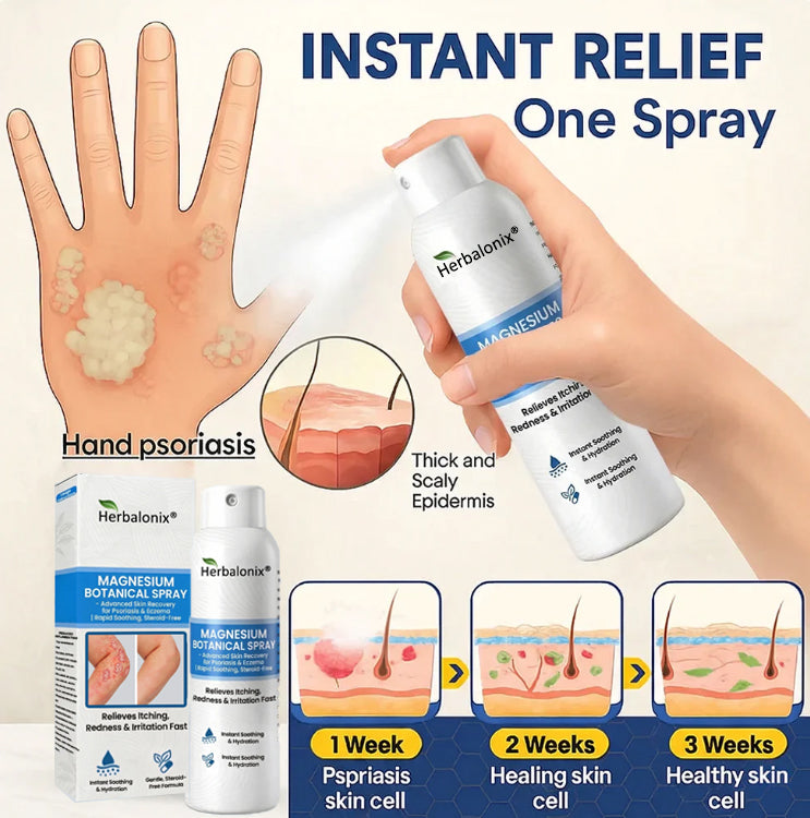 🔥Magnesium Botanical Spray – Advanced Skin Recovery for Psoriasis & Eczema | Rapid Soothing, Steroid-Free