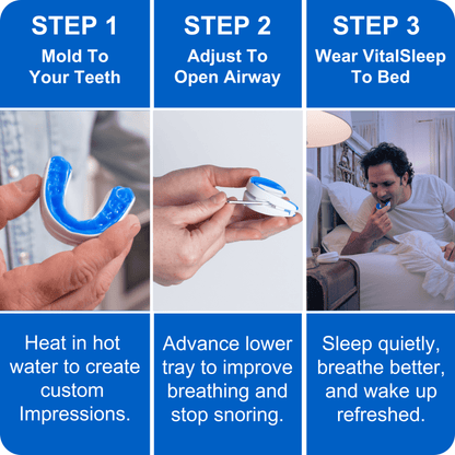 SEURICO™ Stop Snoring Device