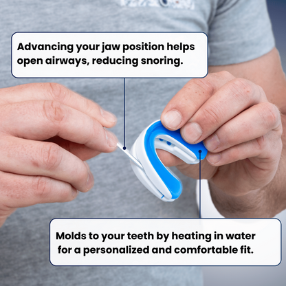 SEURICO™ Stop Snoring Device